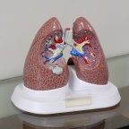 LUNG01